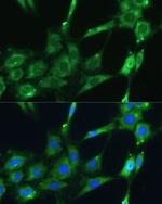 SPARC Antibody in Immunocytochemistry (ICC/IF)