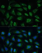 SPARC Antibody in Immunocytochemistry (ICC/IF)