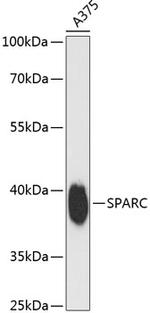 SPARC Antibody in Western Blot (WB)