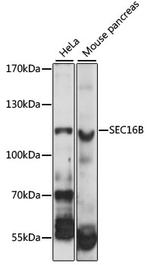 LZTR2 Antibody in Western Blot (WB)