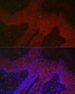 DKK2 Antibody in Immunohistochemistry (Paraffin) (IHC (P))