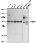 PRPK Antibody in Western Blot (WB)
