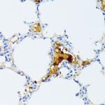 CTRB1 Antibody in Immunohistochemistry (Paraffin) (IHC (P))