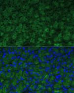 CTRB1 Antibody in Immunohistochemistry (Paraffin) (IHC (P))