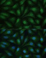 ZIPK Antibody in Immunocytochemistry (ICC/IF)