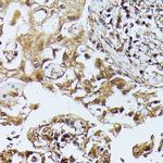 ZIPK Antibody in Immunohistochemistry (Paraffin) (IHC (P))