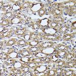 ZIPK Antibody in Immunohistochemistry (Paraffin) (IHC (P))