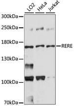 RERE Antibody in Western Blot (WB)