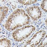 KID Antibody in Immunohistochemistry (Paraffin) (IHC (P))