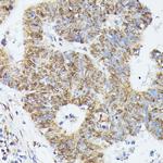 KID Antibody in Immunohistochemistry (Paraffin) (IHC (P))