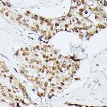 KID Antibody in Immunohistochemistry (Paraffin) (IHC (P))