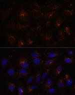 FAM62A Antibody in Immunocytochemistry (ICC/IF)