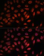 RBM25 Antibody in Immunocytochemistry (ICC/IF)