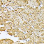 SLC25A5 Antibody in Immunohistochemistry (Paraffin) (IHC (P))