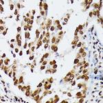 hnRNP D Antibody in Immunohistochemistry (Paraffin) (IHC (P))