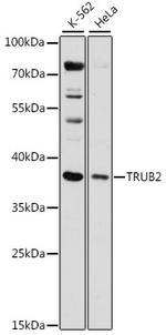 TRUB2 Antibody in Western Blot (WB)