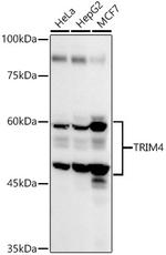 TRIM4 Antibody in Western Blot (WB)