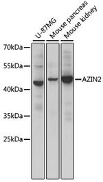 ADC Antibody in Western Blot (WB)