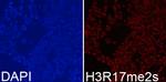 H3R17me2s Antibody in Immunocytochemistry (ICC/IF)