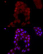 AIM2 Antibody in Immunocytochemistry (ICC/IF)