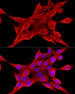 ELOVL4 Antibody in Immunocytochemistry (ICC/IF)