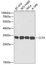 Clathrin Light Chain A Antibody in Western Blot (WB)