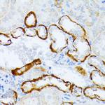 CD123 Antibody in Immunohistochemistry (Paraffin) (IHC (P))