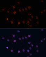 TOM70 Antibody in Immunocytochemistry (ICC/IF)