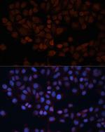 TOM70 Antibody in Immunocytochemistry (ICC/IF)