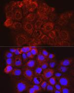 CD63 Antibody in Immunocytochemistry (ICC/IF)