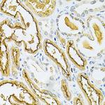 GLRX Antibody in Immunohistochemistry (Paraffin) (IHC (P))