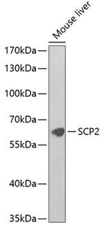 SCP2 Antibody in Western Blot (WB)