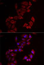 LIMS1 Antibody in Immunocytochemistry (ICC/IF)