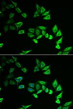 MYOZ2 Antibody in Immunocytochemistry (ICC/IF)