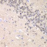 Cyclin C Antibody in Immunohistochemistry (Paraffin) (IHC (P))