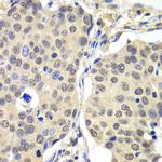 Cyclin C Antibody in Immunohistochemistry (Paraffin) (IHC (P))