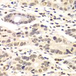 Cyclin C Antibody in Immunohistochemistry (Paraffin) (IHC (P))