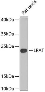 LRAT Antibody in Western Blot (WB)