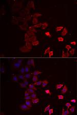 P2X4 Antibody in Immunocytochemistry (ICC/IF)