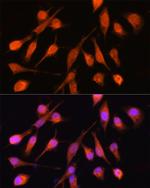 PPM1A Antibody in Immunocytochemistry (ICC/IF)