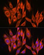 PPM1A Antibody in Immunocytochemistry (ICC/IF)