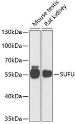 SUFU Antibody in Western Blot (WB)