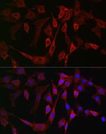 ALOX15B Antibody in Immunocytochemistry (ICC/IF)