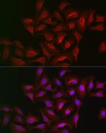 ALOX15B Antibody in Immunocytochemistry (ICC/IF)