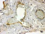 PAR1 Antibody in Immunohistochemistry (Paraffin) (IHC (P))