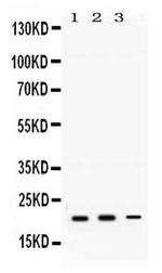 H-Ras Antibody in Western Blot (WB)