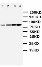 PI3K p85 alpha Antibody in Western Blot (WB)