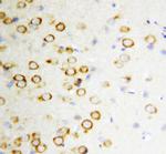 GDNF Antibody in Immunohistochemistry (Paraffin) (IHC (P))