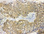 Haptoglobin Antibody in Immunohistochemistry (Paraffin) (IHC (P))