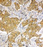 HSC70 Antibody in Immunohistochemistry (Paraffin) (IHC (P))